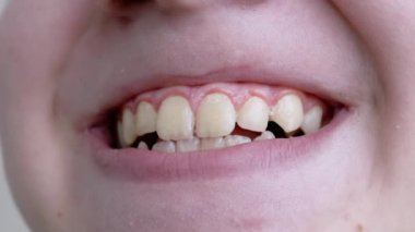 Gülümseyen Dişleri Gösteren Bir Çocuğun Yüzünün Yakın Çekimi. Yavaş çekim