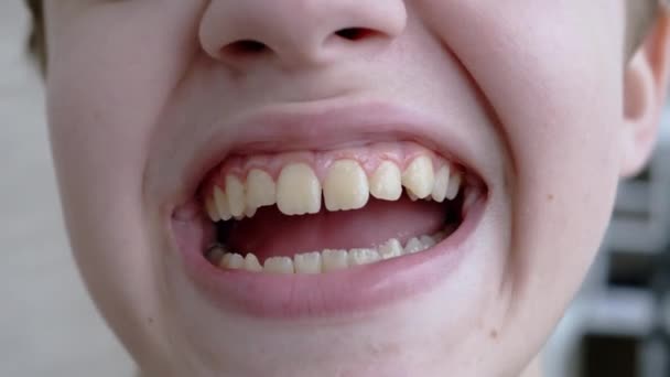 Close-up van het gezicht van een glimlachend kindentanden. Langzame beweging — Stockvideo