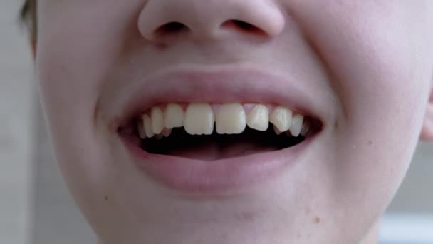 Zbliżenie twarzy uśmiechniętego dziecka pokazującego zęby. Zwolnione tempo — Wideo stockowe