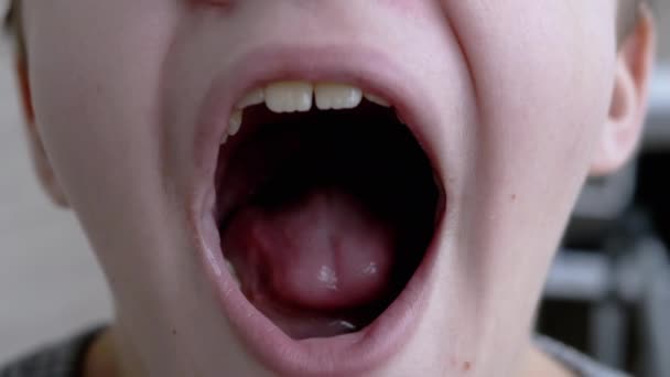 Uma criança cansada e sonolenta abre sua boca, Yawns mostra seus dentes, língua — Vídeo de Stock