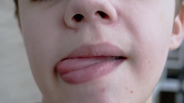 Close-up do rosto de uma criança sorridente que mostrando dentes, língua. Movimento lento — Vídeo de Stock