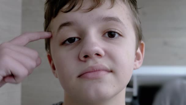 Portrait of a Disgruntled Child who Twists his Finger to Temple. Close up. 4K — Stock Video