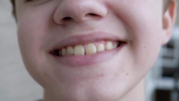 Primer plano de la cara de un niño sonriente mostrando dientes. En cámara lenta. — Vídeos de Stock