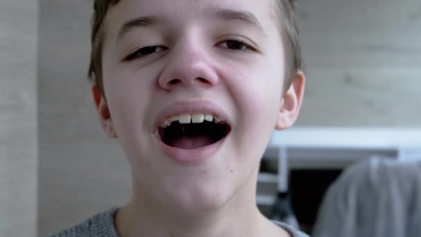 Een vermoeid, slaperig kind opent zijn mond wijd, geeuwt toont zijn tanden, tong — Stockvideo