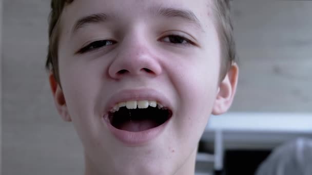 Un niño cansado y somnoliento abre su boca, bosteza muestra sus dientes, lengua — Vídeos de Stock
