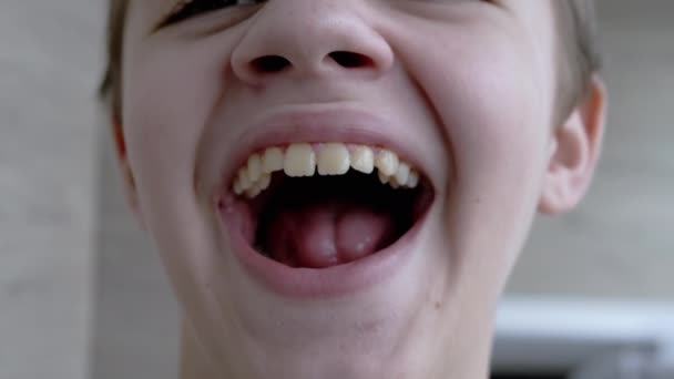 Uma criança cansada e sonolenta abre sua boca, Yawns mostra seus dentes, língua — Vídeo de Stock