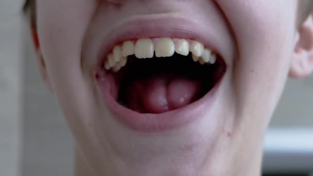 Ein müdes, schläfriges Kind reißt den Mund weit auf, gähnt die Zähne, die Zunge — Stockvideo