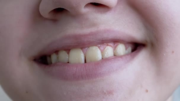 Κοντινό πλάνο του προσώπου ενός χαμογελαστού παιδιού που δείχνει δόντια. Αργή κίνηση — Αρχείο Βίντεο