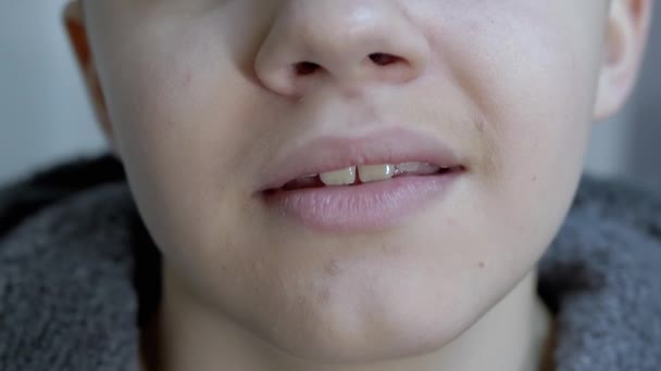 Cansado, el niño soñoliento abre su boca, bosteza muestra sus dientes, lengua — Vídeos de Stock