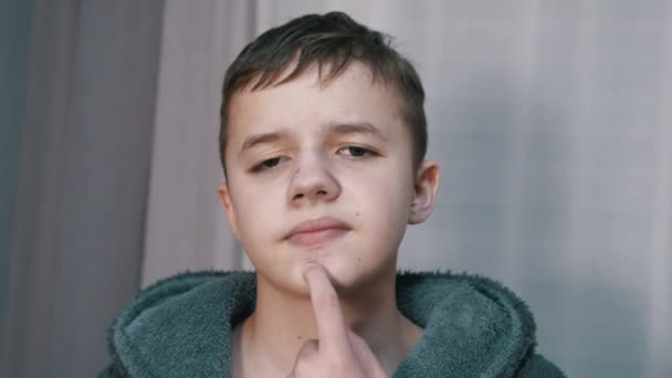 Frustrated Teenager Touches, Pressing Pimples on his Face with Finger in Room — Stock Video