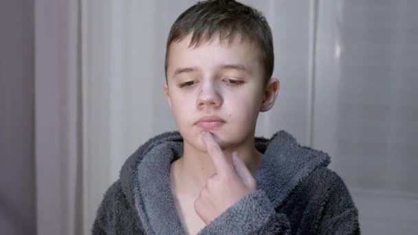 Frustrated Teenager Touches, Pressing Pimples on his Face with Finger in Room — Stock Video