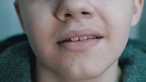 Unavené, ospalé dítě otevře ústa doširoka, zívá ukazuje své zuby, jazyk — Stock video