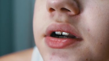 Face, Lips ve Cildi Sivilceli Konuşan Bir Genç 'in Ağzı