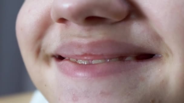 Close-up de lábios e boca de uma criança com um sorriso largo bonito com dentes — Vídeo de Stock