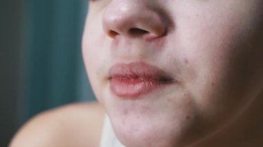 Face, Lips ve Sivilceli Konuşan Bir Genç 'in Ağzı