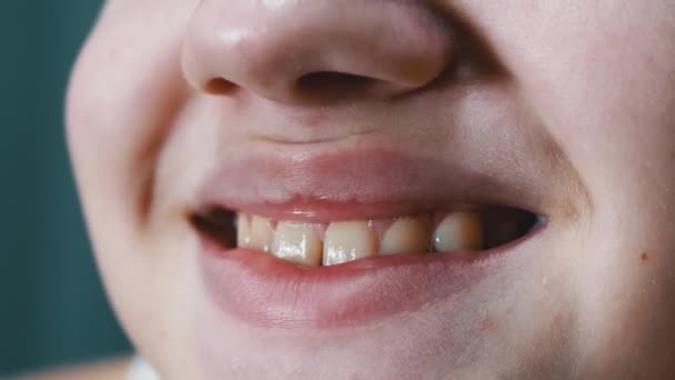 Dişleriyle Güzel Geniş Gülümseyen Bir Çocuğun Ağzı ve Dudaklarının Yakın Çekimi — Stok video