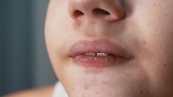 Közelkép egy ideges gyerek arcáról, aki a fogával harapdálja a száját. Makró — Stock videók