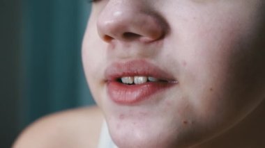 Face, Lips ve Sivilceli Konuşan Bir Genç 'in Ağzı