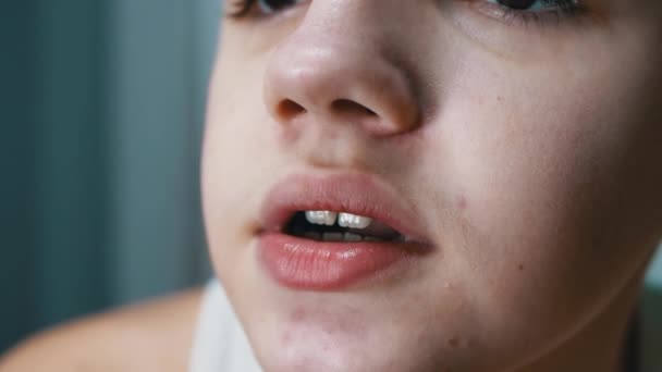 Close-up of Face, Lips, and Mouth of a Talking Teenager with Acne on the Skin — Vídeo de stock