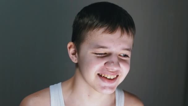 Portrait of a Smiling, Speaking Teenager with Acne on Face, Looking Down — Video