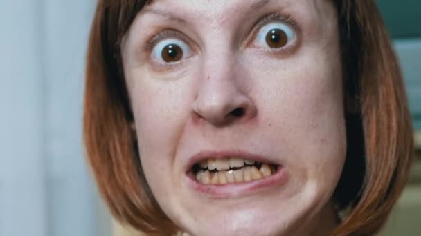 Close-up Facial Expressions of a Crazy Woman with Bulging Eyes, Crooked Teeth — Video