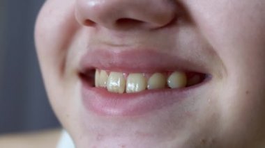 Dişleriyle Güzel Geniş Gülümseyen Bir Çocuğun Ağzı ve Dudaklarının Yakın Çekimi