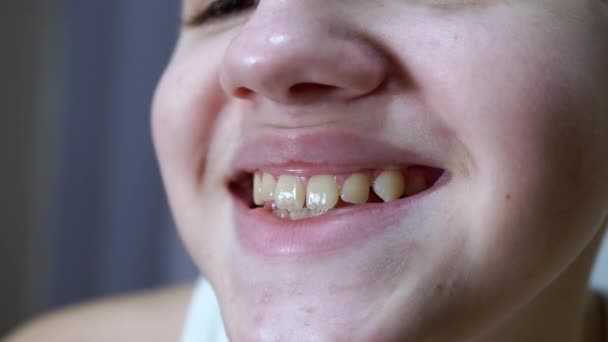 Close-up of Lips and Mouth of a Child with a Beautiful Wide Smile with Teeth — Video
