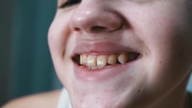 Dişleriyle Güzel Geniş Gülümseyen Bir Çocuğun Ağzı ve Dudaklarının Yakın Çekimi