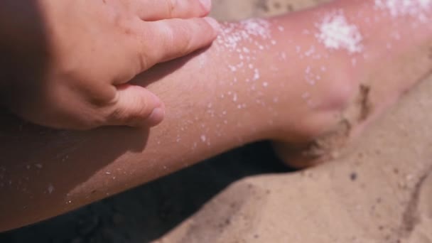 Mão Feminina Aplica Esfrega Protetor Solar Pele Vermelha Bronzeada Uma — Vídeo de Stock