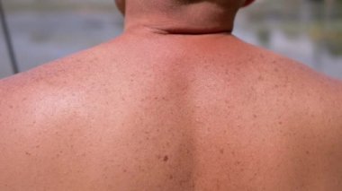 Tanned Shoulders, Back of a Bald Male Standing on the River Bank on Nature. Close-up. Back view. Resting, tanned guy with freckles, moles on back from the scorching sun. Fishing. Weekend. Summertime.