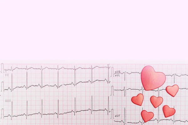 Electrocardiography ECG. Heart lies on the cardiogram. Place for your text. Caring for the health of the heart. Copy space. Pink background. Medical research. Medical service — Stock Photo, Image