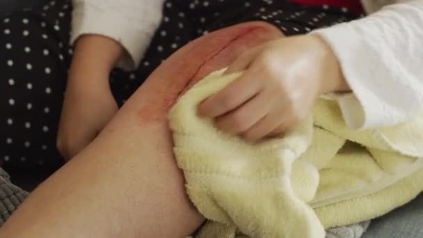 Femme Maison Prenant Soin Genou Après Chirurgie — Video