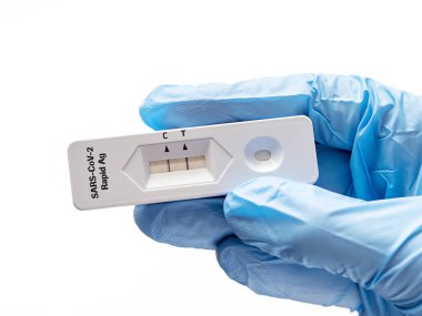 Coronovirus in Hands için pozitif test. Salgın Hastalık ve Tedavi Koruması kavramı