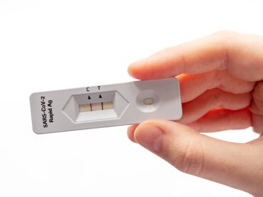 Coronovirus in Hands için pozitif test. Salgın Hastalık ve Tedavi Koruması kavramı