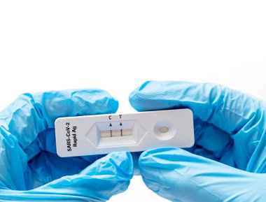 Coronovirus in Hands için pozitif test. Salgın Hastalık ve Tedavi Koruması kavramı