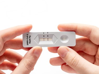 Coronovirus in Hands için pozitif test. Salgın Hastalık ve Tedavi Koruması kavramı