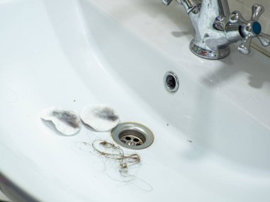 Dirty white sink with hairs and used cotton pads. Untidy. Muddy. Stainless. Washbowl. The washbasin is dirty, unhygienic, has scale and rust. Bathroom cleaning concept. Domestic bath drain sink.