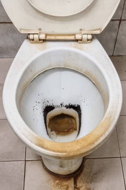 Kirli ve pis kokulu klozet kapağı ve tuvalette kireç pulu.