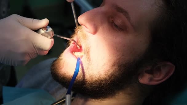 치과 위생병, 물로 깨끗 한 사람의 치아, 치과 예약 — 비디오