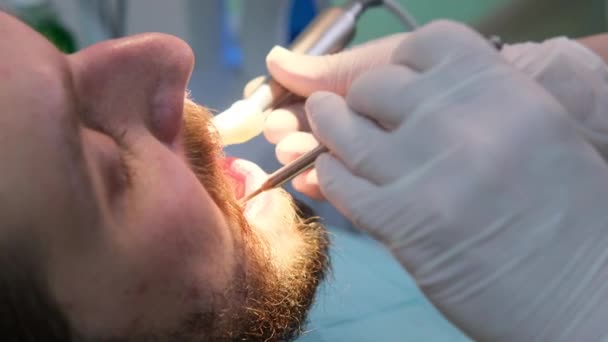 Зубний стоматолог, стоматолог тренує зуб — стокове відео