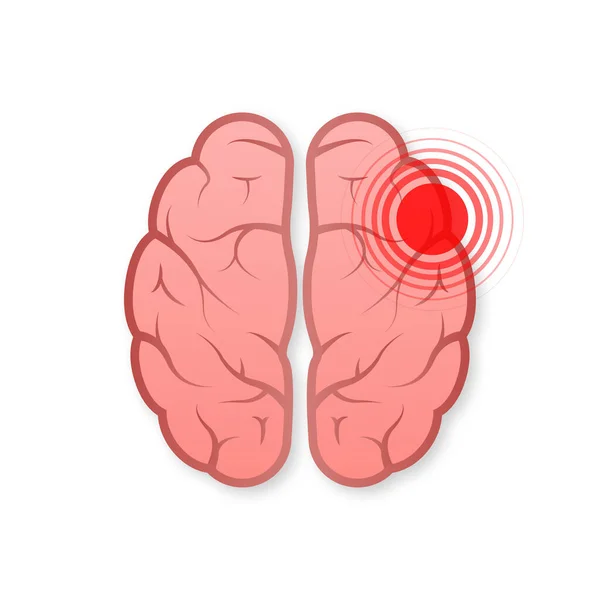 Headache Brain Health Care Migraine Vector Illustration — Image vectorielle