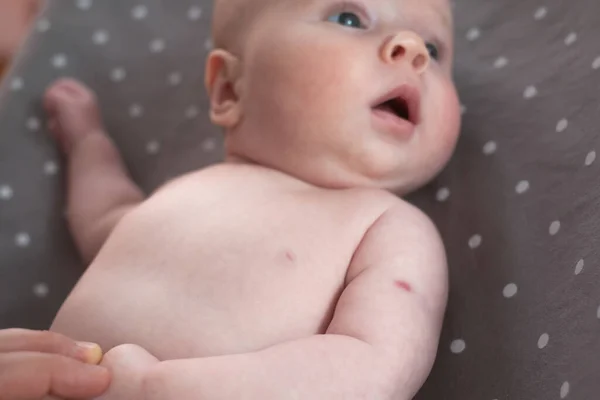 Newborn with traces of BCG vaccination orthe TB vaccine-on his arm. — Stock Photo, Image