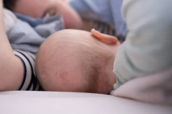 Bald spot on the back of the infant baby head. Rubbed hair of the toddler child — Stock Photo, Image