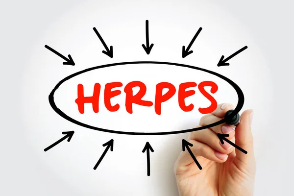 Herpes Texto Con Flechas Concepto Médico Para Presentaciones Informes —  Fotos de Stock