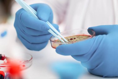 Bilim adamı bakteri, doku ve kan örnekleriyle Petri Tabakları ile çalışıyor. Antibiyotikler için ilaç kavramı, DNA ile hastalıkların iyileştirilmesi,.