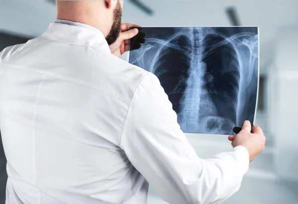 Médico Masculino Examinando Una Radiografía Tórax — Foto de Stock