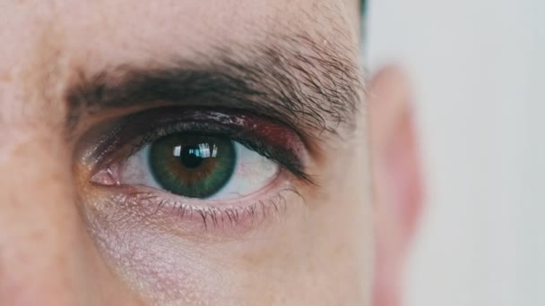 Blåmärken över ögat på en man, närbild — Stockvideo