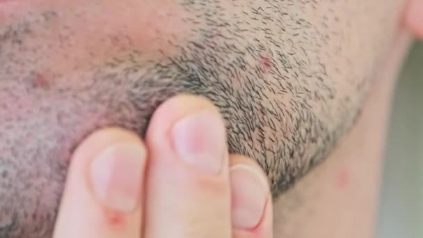 Male Bristle Close-up, Young Man Touching by Hand the Stubble on His Face — Stok Video