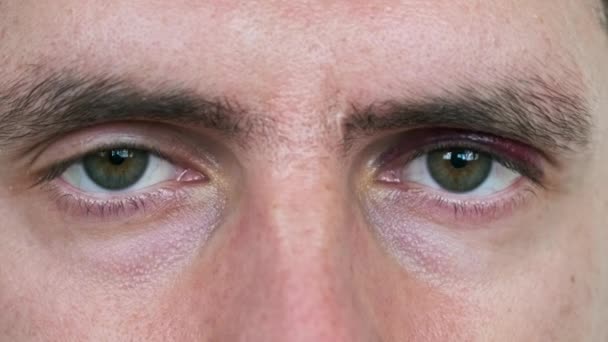 Verdadero Ojo Morado Cara Masculina Joven Moretón Párpado Hombre Cerca — Vídeos de Stock