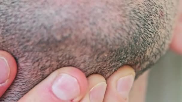 Male Bristle Close Young Man Touching Hand Stubble Face Rubs — Stockvideo